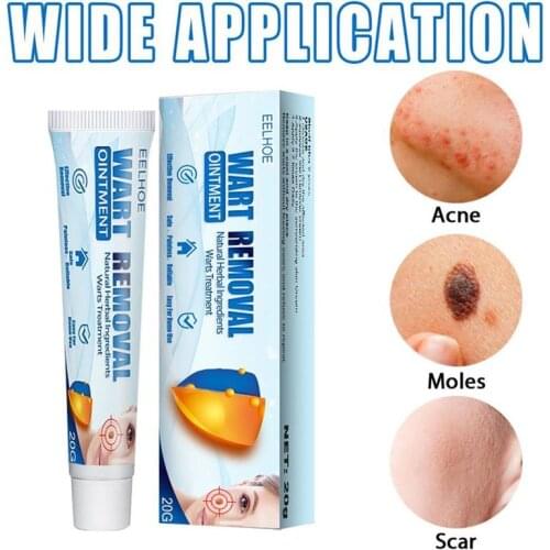 Wart Removal Body Warts Treatment Cream Skin Tag Wart Removal Cream Tag Removal Cream Face Body Care