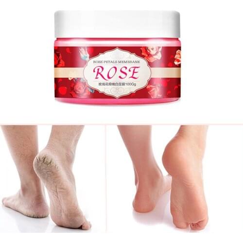 Whitening Moisturizing Foot Mask Exfoliating Itching Foot Care Rose Foot Mask Peeling Wax Film Skin Care Peel Off Dead Skin