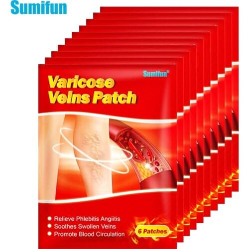 60pcs Sumifun Varicose Veins Plaster Vasculitis Phlebitis Spider Cream Varicosity Angiitis Removal Herbal Medical Plaster K06201
