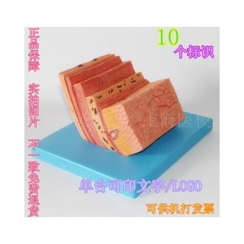 Stomach wall Zoom model Gastric anatomy stomach wall hierarchical model 13*17*19cm