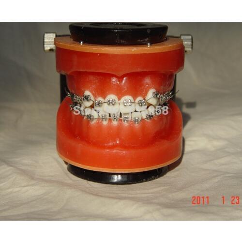 Senior Wax Dike Orthodontic Practice Model,Wax Dike Teeth Orthodontic Practice Model,Wax Dike Wrong Jaw Correction Model