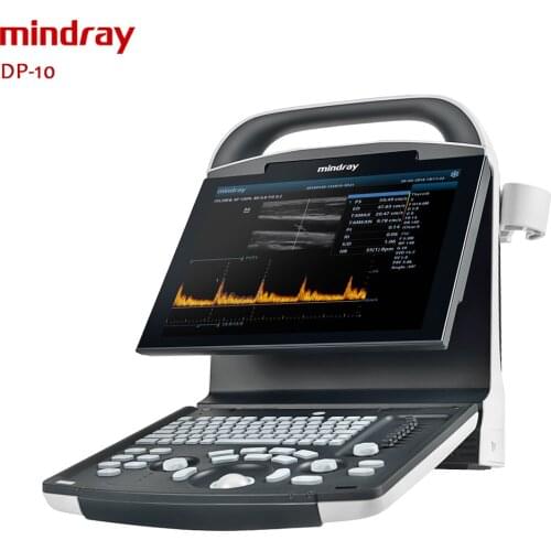 Mindray ultrasound dp 10 cheaper price for hospital use