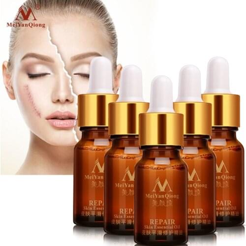 5pcs/lot Repair Skin Essential Oil Scar Ance Treatment Care Anti Acne Anti Scar, Skin Whitening Face Massage Body Essential Oil