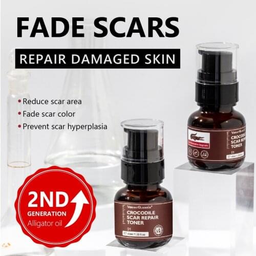 VIBRANT GLAMOUR Crocodile Scar Repair Toner Reduce Scar Area Fade Scar Color Prevent Scar Hyperplasia Sensitive Skin Deep Care