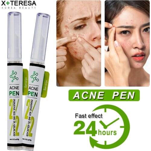 2% Salicylic Acne Treatment Cream Natural Ginseng Aloe Vera Essence Pimples Cream Acne Scar Spot Removal Face Cream Whitening