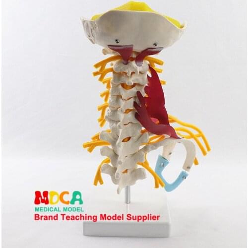 Anatomical Human Cervical Spinal Cord Nerve Model Occipital Bone Skeleton Model Medical Teaching