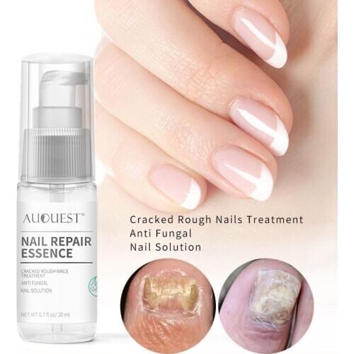 20ml Liquid Nail Infection Repair Pen Onychomycosis Anti Fungal Toe Fungus Treatment Toe Finger Nail Health Accessories TSLM1