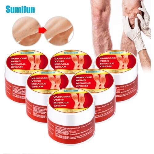 5Pcs Sumifun Varicose Veins Ointment Relieve Thigh Blood Vessels Swelling Phlebitis Vasculitis Remove Spider Pain Relief Plaster