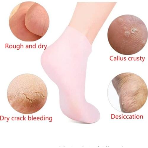 1Pair Feet Care Socks Feet Protector Pain Relief Anti Cracking Prevention Moisturize Dead Skin Removal Sock