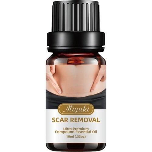 Natural Stretch Marks Remover Obesity Postpartum Marks Removal Essential Oils Pure Anti Repair Cream Skin Care Z