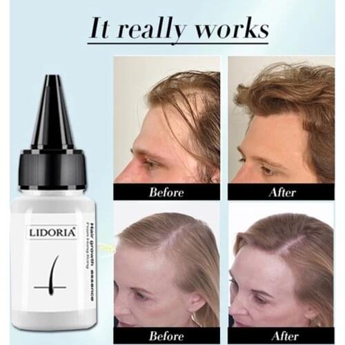 Fast Hair Growth Anti Hair Loss Serum Anti Preventing Hair Lose Damaged Hair Repair Treatment Eyelash Eyebrow Growing Thick Care