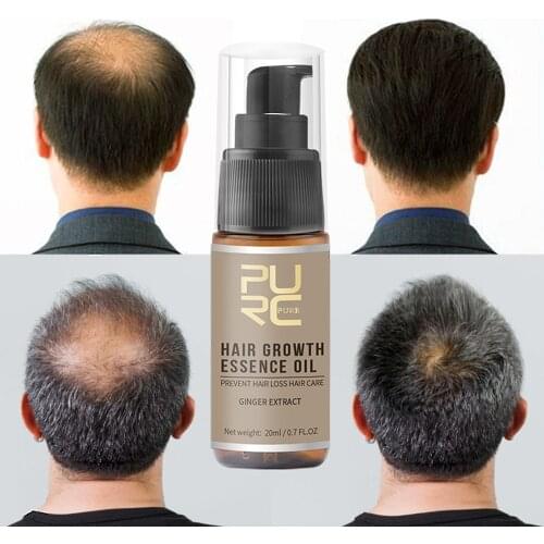 Hair Growth Spray Fast Grow Hair Nourishing Cure Scalp Root Hair Loss Treatment For Thinning Hair Hair Care 20ml
