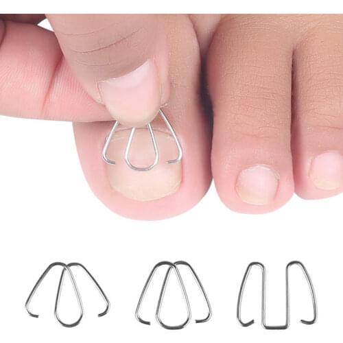 3Pairs Front nail hook/rubber band Nail Art Ingrown Toe Nail Correction Toenail Nail Ingrown Clip Orthosis Paronychia Pedicure