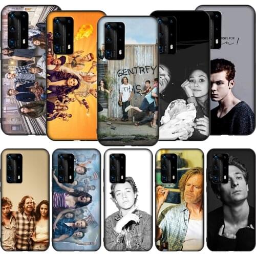 T165 Shameless TV Show Case for Honor Note 6A 7A 7C 7X 8 8A 8C 8X 9 9A 9X 10X 20 20S 30 Y6P Lite Pro