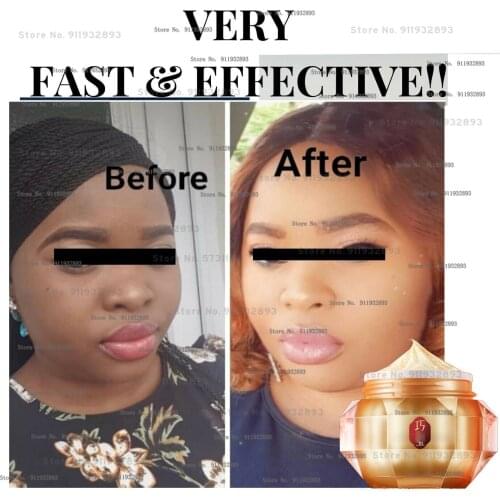 ACTIVE face cream, WHITENING/LIGHTENING and hyperpigmentation face cream