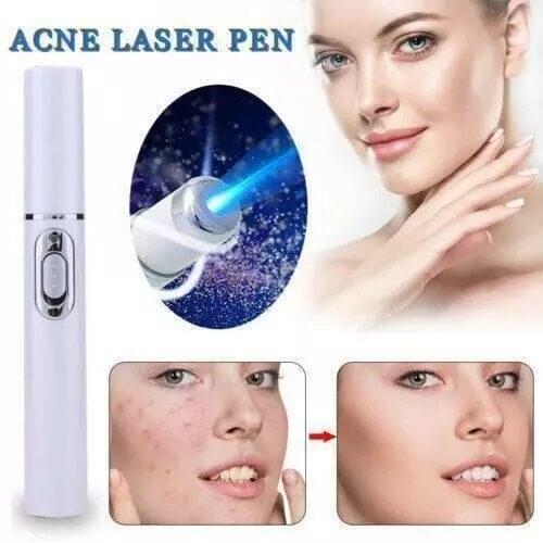 Hot Sell Blue Light Therapy Varicose Veins Treatment Laser Pen Soft Scar Wrinkle Removal Treatment Acne Laser Pen Massage Relax
