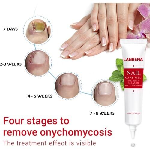 LANBENA Nail Protector Cream Toe Nail Fungus Treatment Gel Herb Finger Nails Repair Cream Remove Onychomycosis Anti Infectio