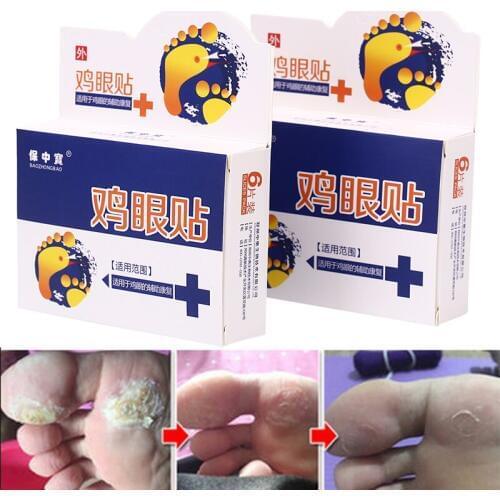 6PCS Foot Care Medical Plaster Foot Corn Removal Calluses Plantar Warts Thorn Plaster Health Care For Relieving Pain