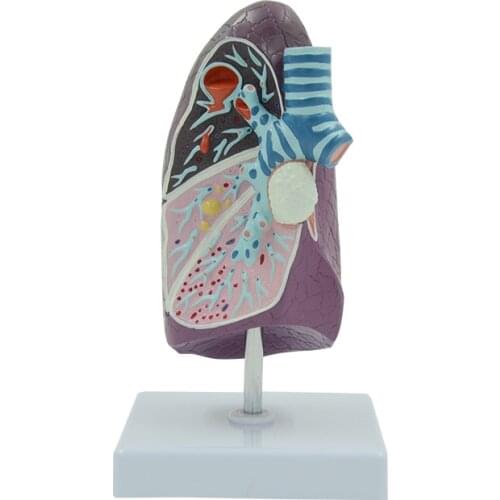 Pathological Lung Anatomy Model of Human Smoker Medical Science Teaching Resources Drop Shipping
