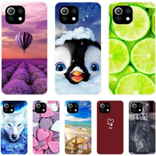 For xiaomi Mi 11 | Mi 11 Lite 5G 4G | Mi 11i Case Back For Xiaomi Mi 11 Ultra Phone Cover Silicon Funda black tpu case