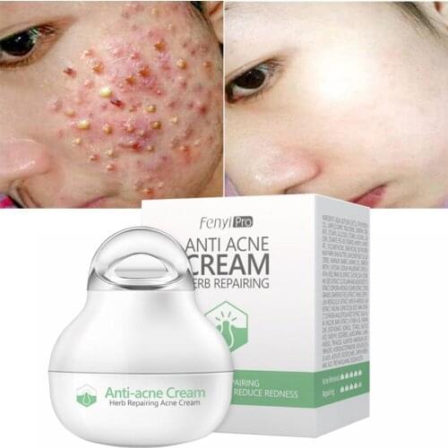 Effective anti-acne cream acne treatment fade acne spots oil control shrink pores whitening moisturizing acne cream skin care