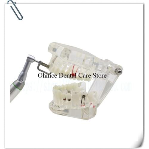 Dental Orthodontic Instrument Interproximal enamel reduction IPR kit/Dental Contra Angle Orthodontic IPR