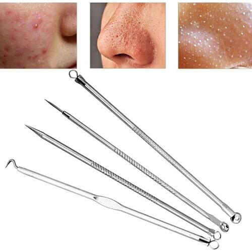 4Pcs New Nobby Pimple Acne Remover Blemish Comedone Extractor Needles Tool Set MOLF