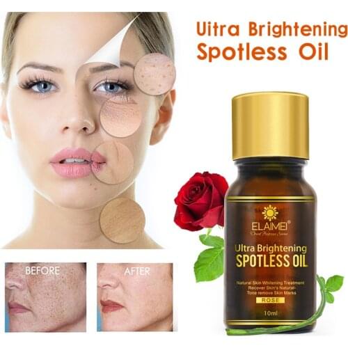 Moisturizing Freckle Rose Essential Oil Fade Fine Lines Massage Face Body Essential Remove spots Uitra Brightening Spotless Oil