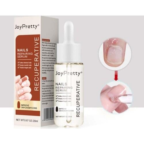 20ml Nail Fungal Treatment Feet Care Essence Nail Foot Toe Nail Fungus Removal Gel Anti Infection Paronychia Onychomycosis