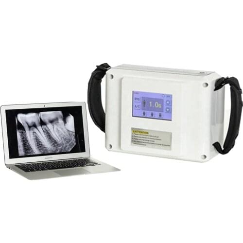 Portable Dental X-ray System Unit Medical Equipment with Touch-Screen