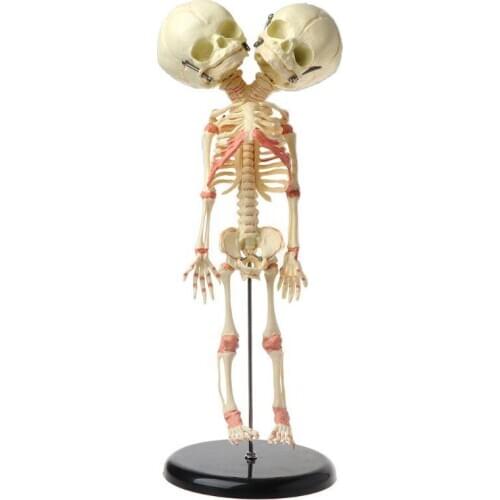 Human Double Head Baby Skull Skeleton Anatomy Brain Display Study Teaching Anatomical Model