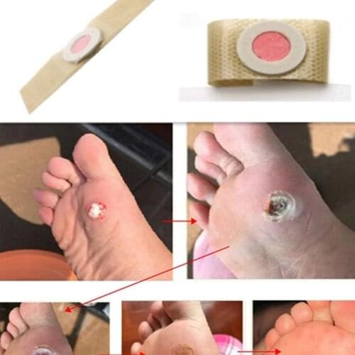 5pcs Sumifun Foot Corn Removal Killer Calluses Plantar Warts Thorn Pain Relief Curative Plaster Medical Sticker Curative Plaster