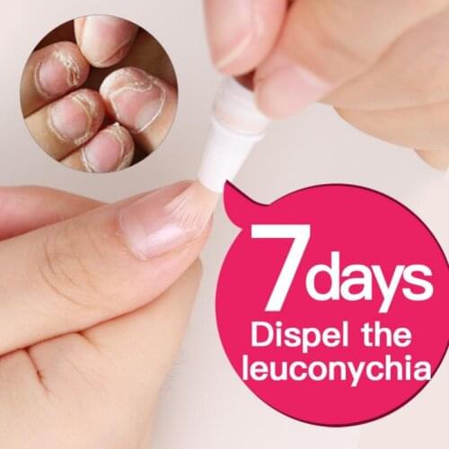 Nail Repair Liquid Treatment Pen Onychomycosis Paronychia Anti Nail Care Solution Nail Oil Nutrition Pen TSLM1