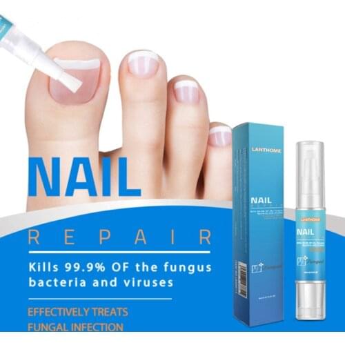 4ml Powerful Nail Treatment Pen Onychomycosis Paronychia Anti Fungal Nail Infection Chinese Herbal Toe Fungus Care Repair Serum