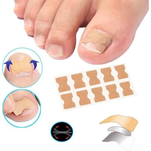 4-60Pcs Nail Strips Anti-roll Nail Free Glue Toe Inlay Nail Corrector Nail Patch Correction Stickers Toenail Nail Care Foot Care