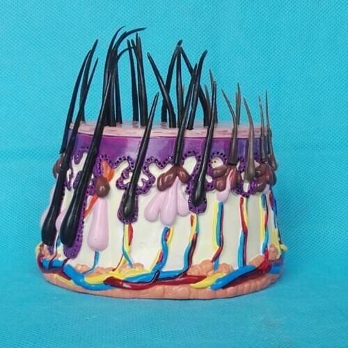 Human skin anatomy magnified model hair follicle skin structure medical teaching hair transplant explanation display