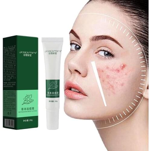 Acne Removal Cream Acne Treatment Fade Acne Spots Oil Control Shrink Pores Whitening Moisturizing Acne Cream Skin Care