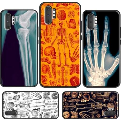 X-Ray Human Anatomy Case For Samsung Galaxy S10 S8 S9 S20 S21 Plus Note 20 Ultra 10 9 S10e S20 FE Phone Cover