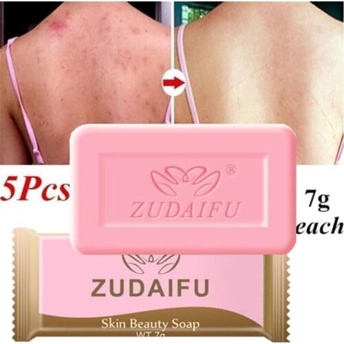 1/5pcs Sulfur Soap Anti-mites Anti-acne Body Cleansing Skin Treatment Soap Acne Psoriasis Seborrhea Eczema Anti Fungus Soap