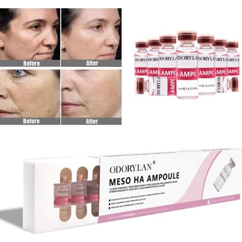 10 vials Cross-linked HA Hyaluronic Acid Pure Micro Molecular Mesotherapy Collagen Hyaluronic Acid Whitening BB Cream Foundation