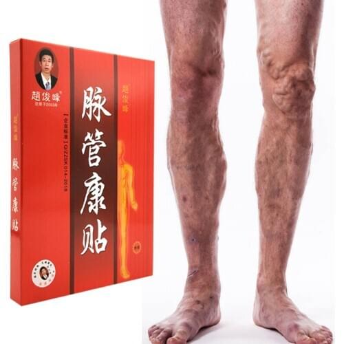 4pcs Spider Veins Varicose Treatment Plaster Varicose Veins Cure Patch Vasculitis Natural Solution Herbal Patches