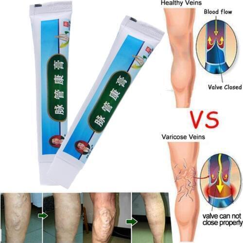 5pcs Chinese Natural Herbal Medicine for Varicose Veins Ointment Vasculitis Inflammation Leg MassageVaricose Veins Skin Cream