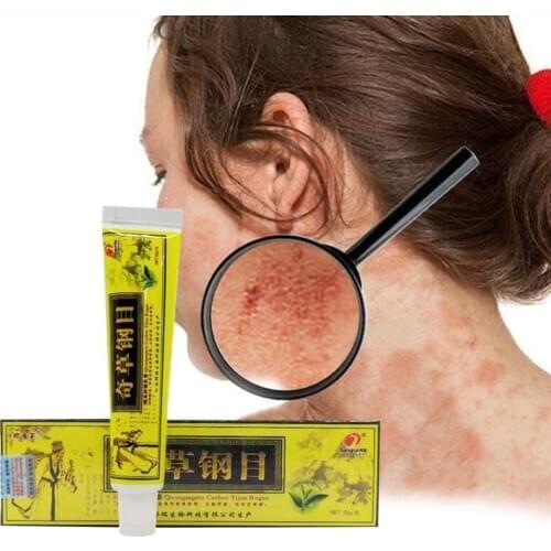 Advanced Body Psoriasis Cream For Dermatitis and Eczema Pruritus Psoriasis Ointment Herbal Creams