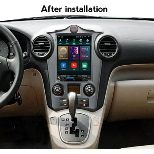 4G LTE Android 11 For KIA Carens 2007 2008 2009 2010 2011 Multimedia Stereo Car DVD Player Navigation GPS AutoRadio Tesla Screen