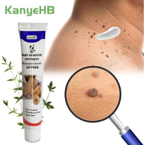 Warts Remover Ointment Wart Treatment Cream Skin Tag Remover Herbal Extract Corn Calluses Plaster Wart Ointment Body Care 1pcs