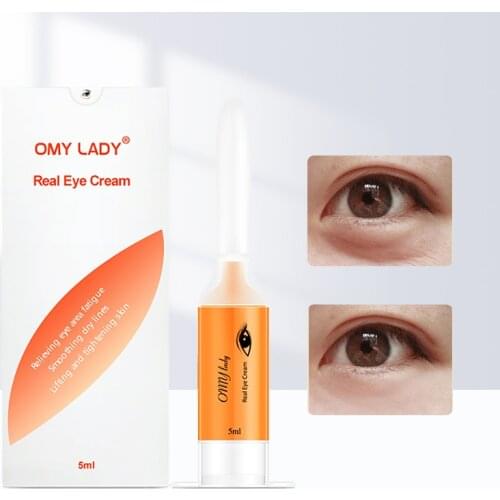 OMY LADY Instant Remove Eye Bags Cream Anti Puffiness Gel Dark Circles Delays Aging Fades wrinkles Firming Brighten Skin Unisex