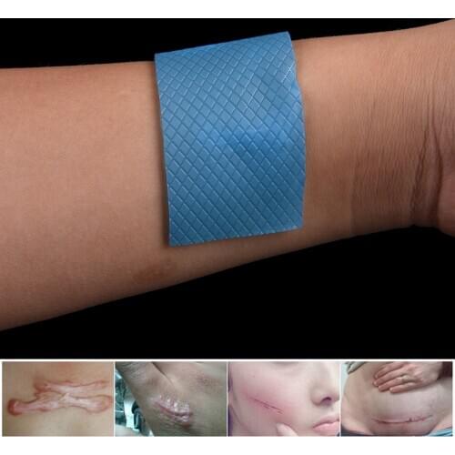 Silicone Gel Sheet 3.5*7cm Wound Marks Removal Cesarean Section Hypertrophic Keloid Skin Scars Therapy Treatment Scar Away Patch