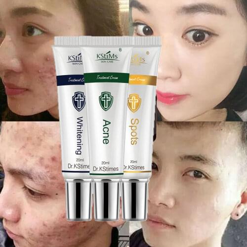 KStimes Herbal Anti Acne Cream Korean Blemish Acne Pimple Treatment Cream Pimple Acne Scar Removal Cream with Tea Tree Oil