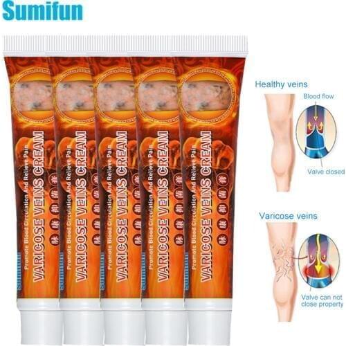 Sumifun 5pcs Varicose Vein Cream Varicosity Angiitis Remedy Ointment Phlebitis Spider Veins Relief Chinese Herbal Cream D3176