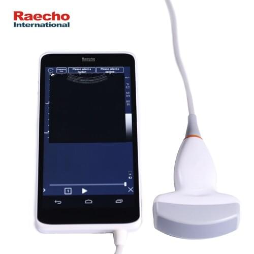 Professional Wireless Handheld Ultrasound Scanner with Convex Probe